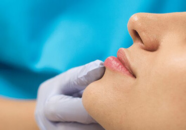 Lip Filler Treatment